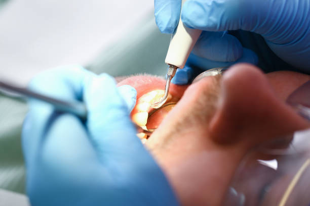 Best Emergency Treatment for Jaw Pain or Injury in Pembroke Pines, FL