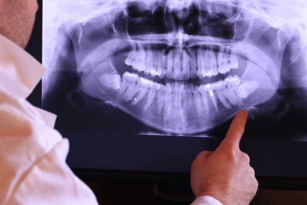 Best Dental Abscess Treatment in Pembroke Pines, FL
